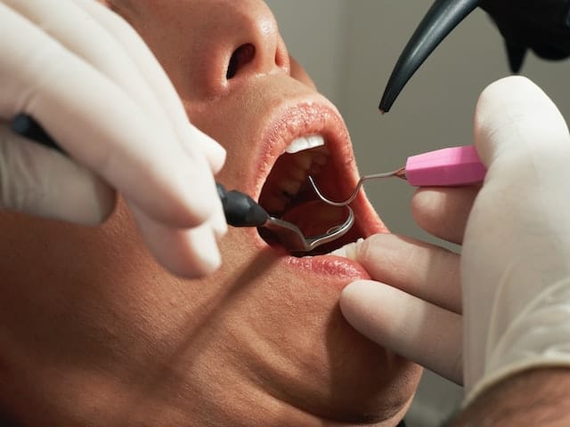 Leczenie jamy ustnej u chirurga szczękowego w Warszawie