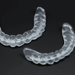 Czy Aparaty Clear Aligner są dobrym rozwiązaniem dla leczenia stłoczonych zębów?