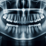 rentgen zębów łódź